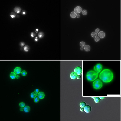 Image shows cellular localization of the atypical transporter PDR6 in cryptococcal cells.
